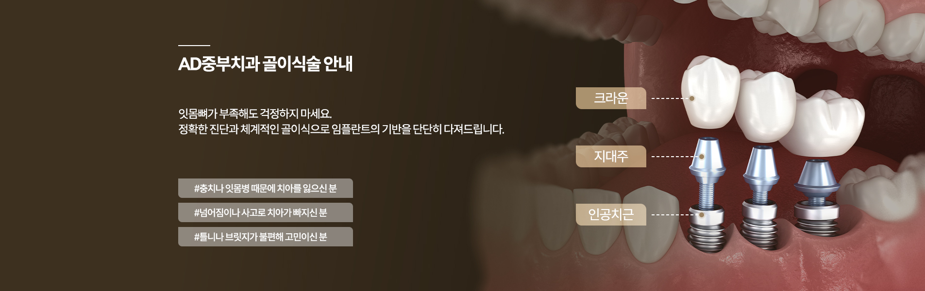 AD중부치과의특별함_08